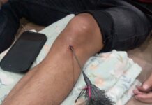 Dibidik Panah Saat Dibegal, Pemuda Medan Dirawat di RSPM